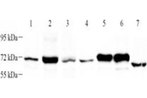 Western blot analysis of PLAP (ABIN7075090),at dilution of 1: 1000,Lane 1: HeLa cell lysate,Lane 2: HaCaT cell lysate,Lane 3: SiHa cell lysate,Lane 4: SKBR3 cell lysate,Lane 5: HepG2 cell lysate,Lane 6: A431 cell lysate,Lane 7: Mouse uterus tissue lysate