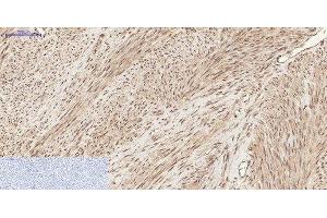 Immunohistochemistry of paraffin-embedded Human uterus tissue using Phospho-CHEK2 (Thr68) Polyclonal Antibody at dilution of 1:200 (CHEK2 Antikörper  (pThr68))
