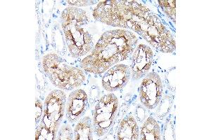 Immunohistochemistry of paraffin-embedded mouse kidney using PEG10 Rabbit pAb (ABIN3016692, ABIN3016693, ABIN1681320 and ABIN6219814) at dilution of 1:100 (40x lens). (PEG10 Antikörper  (AA 1-325))