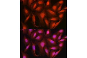 Immunofluorescence analysis of U2OS cells using Ataxin-3  Rabbit pAb (ABIN3021828, ABIN3021829, ABIN3021830, ABIN1512615 and ABIN6216049) at dilution of 1:100 (40x lens). (Ataxin 3 Antikörper  (AA 1-364))