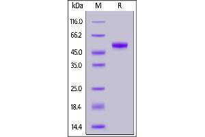 Biotinylated Human CD5, His,Avitag on  under reducing (R) condition.