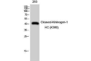 Western Blotting (WB) image for anti-Kininogen-1 Heavy Chain (Lys380) antibody (ABIN3172805) (Kininogen-1 Heavy Chain (Lys380) Antikörper)