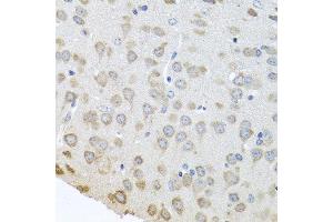 Immunohistochemistry of paraffin-embedded mouse brain using PABPC4 antibody at dilution of 1:100 (40x lens). (PABPC4 Antikörper)