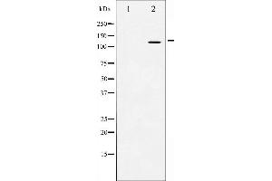 Western blot analysis of Amyloid beta A4 expression in HeLa whole cell lysates,The lane on the left is treated with the antigen-specific peptide. (APP Antikörper  (C-Term))