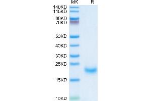 SDS-PAGE (SDS) image for Receptor Tyrosine Kinase-Like Orphan Receptor 1 (ROR1) (AA 308-395) protein (His tag) (ABIN7275528)
