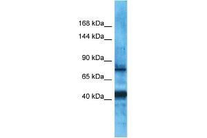 Host:  Rabbit  Target Name:  PDZRN3  Sample Type:  Uterus Tumor lysates  Antibody Dilution:  1. (PDZRN3 Antikörper  (Middle Region))