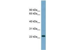 Image no. 1 for anti-ADP-Ribosylation Factor-Like 8A (ARL8A) (AA 107-156) antibody (ABIN6744125) (ARL8A Antikörper  (AA 107-156))