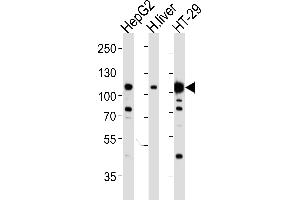 Western blot analysis of lysates from HepG2, H. (c-MET Antikörper  (Catalytic Domain))