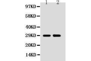 Anti-SSX2 antibody, Western blotting Lane 1: MCF-7 Cell Lysate Lane 2: HELA Cell Lysate