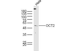 HeLa lysates probed with Rabbit Anti-OCT2 Polyclonal Antibody, Unconjugated  at 1:300 overnight at 4˚C. (Oct-2 Antikörper  (AA 11-100))