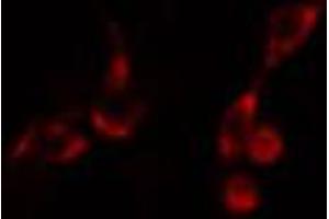 ABIN6266697 staining HeLa cells by IF/ICC. (PDZD2 Antikörper  (N-Term))