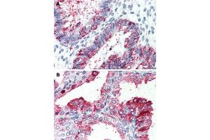 Immunohistochemical staining of human uterus (A) and human prostate (B) with GPR27 polyclonal antibody .