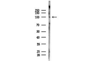 anti-Exportin 6 (XPO6) (N-Term) antibody