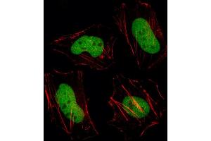 Fluorescent image of Hela cell stained with HDAC1 Antibody (C-term) (ABIN387945 and ABIN2844611)/SH040527D. (HDAC1 Antikörper  (C-Term))