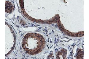Immunohistochemical staining of paraffin-embedded Human breast tissue using anti-FDFT1 mouse monoclonal antibody. (FDFT1 Antikörper)