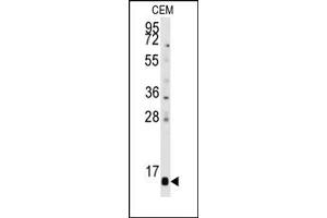 Image no. 1 for anti-Prefoldin Subunit 6 (PFDN6) (C-Term), (N-Term) antibody (ABIN358008) (PFDN6 Antikörper  (C-Term, N-Term))