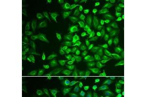 Immunofluorescence analysis of U2OS cells using LRat Polyclonal Antibody
