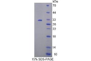 SDS-PAGE analysis of Mouse MFN1 Protein. (MFN1 Protein)