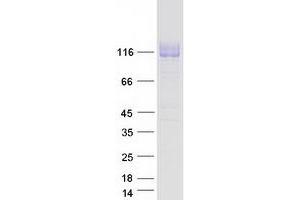 Western Blotting (WB) image for PTK7 Protein tyrosine Kinase 7 (PTK7) protein (Myc-DYKDDDDK Tag) (ABIN2730087)