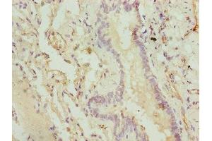 Immunohistochemistry of paraffin-embedded human lung tissue using ABIN7148645 at dilution of 1:100 (CMC1 Antikörper  (AA 1-106))