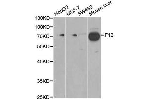 Western blot analysis of extracts of various cell lines, using F12 antibody.