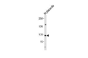 NFATC4 Antikörper  (C-Term)