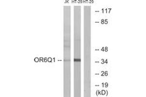 Western blot analysis of extracts from Jurkat/HT-29 cells, using OR6Q1 Antibody. (OR6Q1 Antikörper  (AA 23-72))