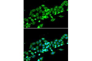 Immunofluorescence analysis of MCF-7 cells using RASSF1 antibody (ABIN6293520). (RASSF1 Antikörper)