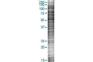 ITM2B transfected lysate. (ITM2B 293T Cell Transient Overexpression Lysate(Denatured))