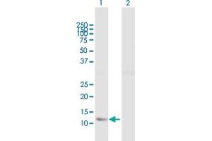 Western Blot analysis of FABP5 expression in transfected 293T cell line by FABP5 MaxPab polyclonal antibody. (FABP5 Antikörper  (AA 1-135))