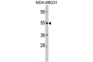 Image no. 1 for anti-Corticotropin Releasing Hormone Receptor 2 (CRHR2) (Middle Region) antibody (ABIN452875) (CRHR2 Antikörper  (Middle Region))