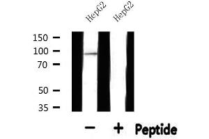 Western blot analysis of extracts from HepG2, using SOX6 Antibody. (SOX6 Antikörper  (N-Term))