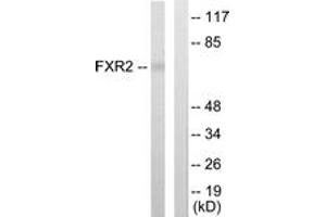 Western blot analysis of extracts from COLO205 cells, using FXR2 Antibody. (FXR2 Antikörper  (AA 551-600))