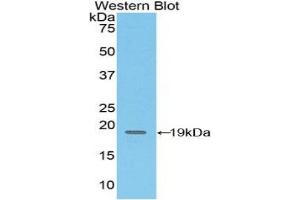 Detection of Recombinant CD97, Mouse using Polyclonal Antibody to Cluster Of Differentiation 97 (CD97) (CD97 Antikörper  (AA 32-173))