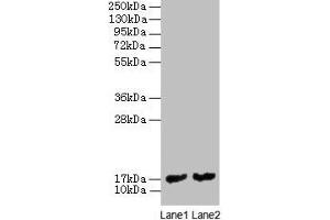 Western blot All lanes: mpt63 antibody at 2 μg/mL Lane 1: Recombinant Mycobacterium tuberculosis Immunogenic protein MPT63 protein 1 μg Lane 2: Recombinant Mycobacterium tuberculosis Immunogenic protein MPT63 protein 0. (MPT63 Antikörper  (AA 30-159))