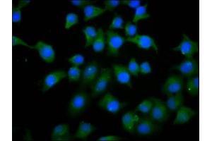 Immunofluorescence staining of A549 cells with ABIN7163100 at 1:133, counter-stained with DAPI. (PHACTR1 Antikörper  (AA 263-387))