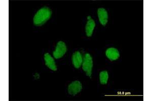 Immunofluorescence of purified MaxPab antibody to DMAP1 on HeLa cell. (DMAP1 Antikörper  (AA 1-467))