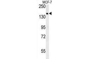 Western Blotting (WB) image for anti-Sterile alpha Motif Domain Containing 9 (SAMD9) antibody (ABIN3002418) (SAMD9 Antikörper)