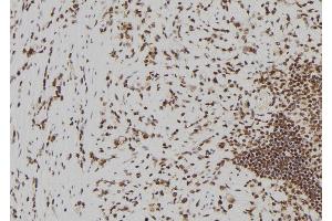 ABIN6273826 at 1/100 staining Human gastric tissue by IHC-P. (Becn2 (N-Term) Antikörper)