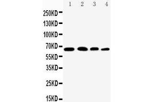 Anti-NF-kB p65 antibody, Western blotting Lane 1: Rat Testis Tissue Lysate Lane 2: HELA Cell Lysate Lane 3: A431 Cell Lysate Lane 4: JURKAT Cell Lysate (NF-kB p65 Antikörper  (Middle Region))