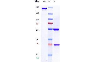 Anti-CD20 Reference Antibody (rituximab) on SDS-PAGE under reducing (R) condition.