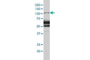 RASA1 monoclonal antibody (M01A), clone 2C12 Western Blot analysis of RASA1 expression in IMR-32 .