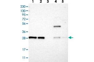 Western blot analysis of Lane 1: RT-4, Lane 2: U-251 MG, Lane 3: Human Plasma, Lane 4: Liver, Lane 5: Tonsil with TMEM234 polyclonal antibody  at 1:250-1:500 dilution. (TMEM234 Antikörper)