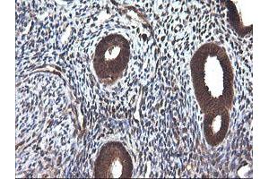 Image no. 1 for anti-Cancer/testis Antigen 1B (CTAG1B) antibody (ABIN1499906)