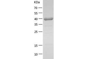 Western Blotting (WB) image for Mitogen-Activated Protein Kinase 14 (MAPK14) (AA 1-360) protein (His tag) (ABIN7123993) (MAPK14 Protein (AA 1-360) (His tag))