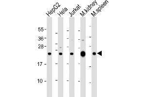 Western Blotting (WB) image for anti-NADH Dehydrogenase (Ubiquinone) 1 beta Subcomplex, 9, 22kDa (NDUFB9) (AA 97-131) antibody (ABIN6244075)