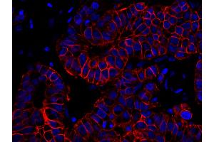Immunofluorescence (IF) image for anti-Receptor tyrosine-protein kinase erbB-2 (ErbB2/Her2) (C-Term) antibody (ABIN7448962) (ErbB2/Her2 Antikörper  (C-Term))