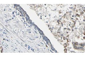 ABIN6268658 at 1/100 staining Human prostate tissue by IHC-P. (PIK3CA Antikörper  (Internal Region))