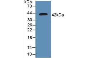 Detection of Recombinant CD63, Human using Polyclonal Antibody to Tetraspanin 30Cluster of Differentiation 63 (CD63) (CD63 Antikörper  (AA 103-203))