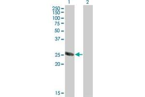 Western Blot analysis of TSSK3 expression in transfected 293T cell line by TSSK3 monoclonal antibody (M07), clone 6B2. (TSSK3 Antikörper  (AA 1-268))
